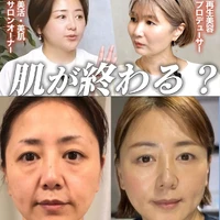 画像327