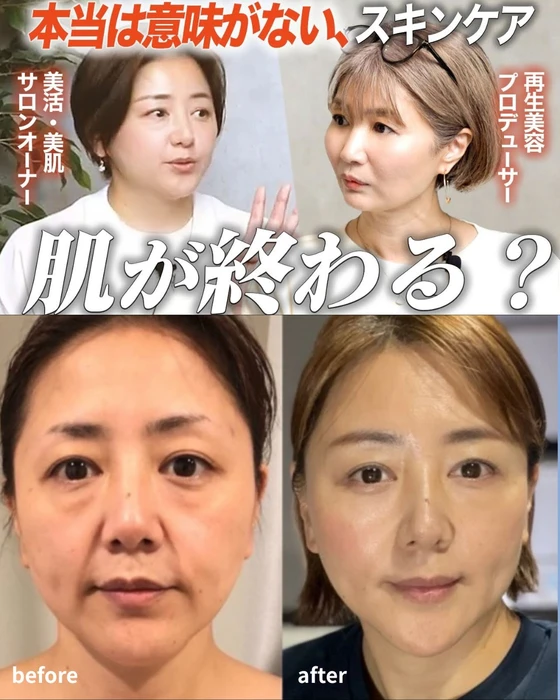 画像327