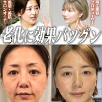 画像332