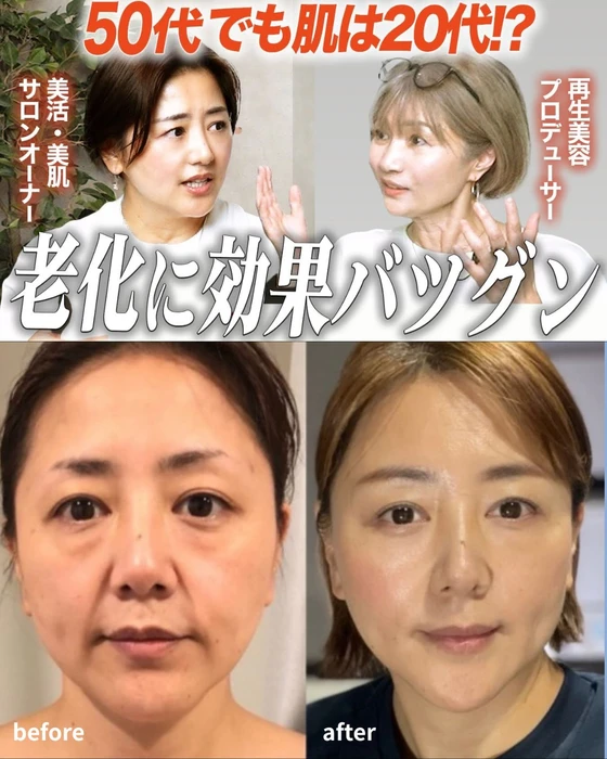 画像332