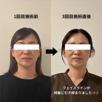 画像347