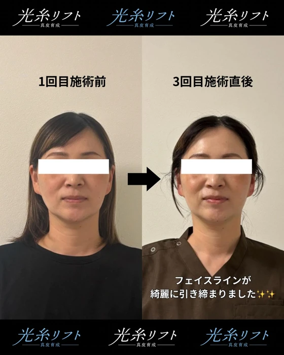 画像347