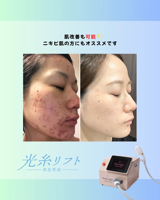 画像367