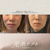 画像425