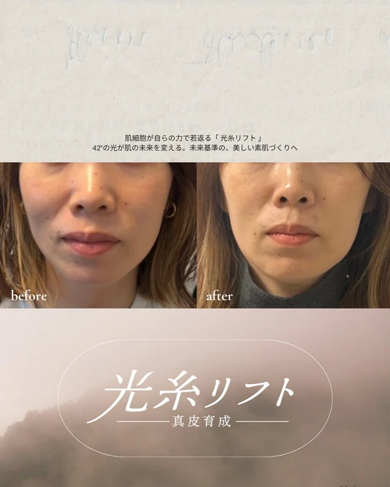 画像425
