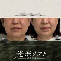 画像513