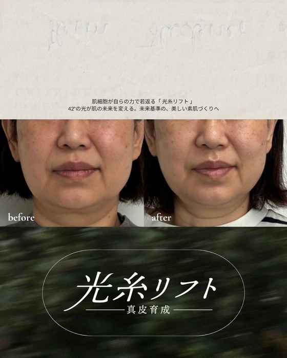 画像513