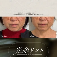 画像533