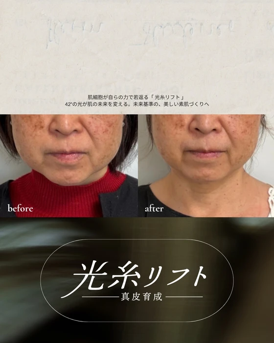 画像533