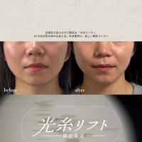 画像555