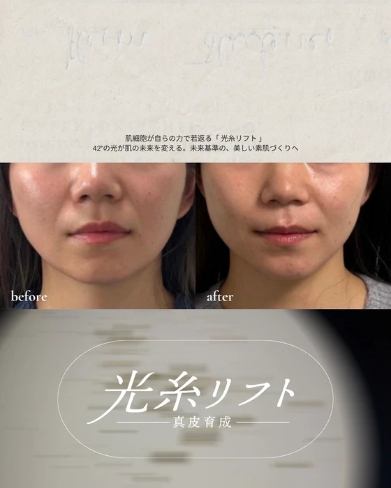 画像555