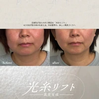 画像572