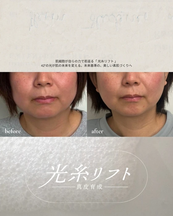 画像572
