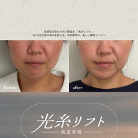 画像626
