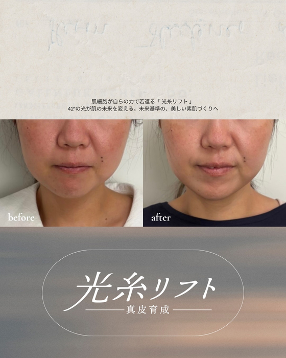 画像626