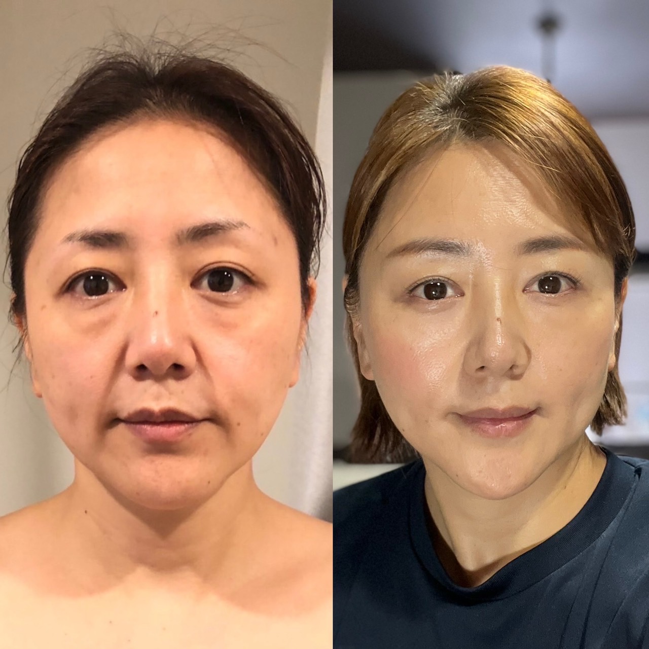4. ビフォーアフターの実績紹介
